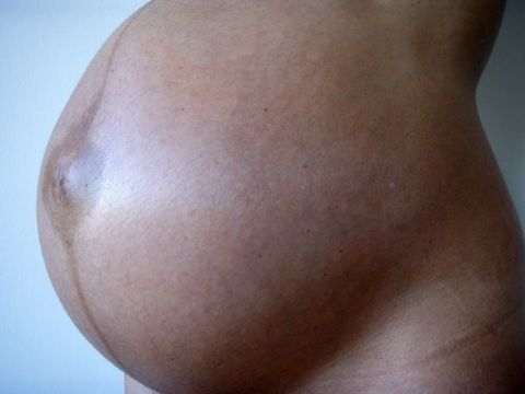 File:2008-02-24 Human abdomen in pregnancy.jpg